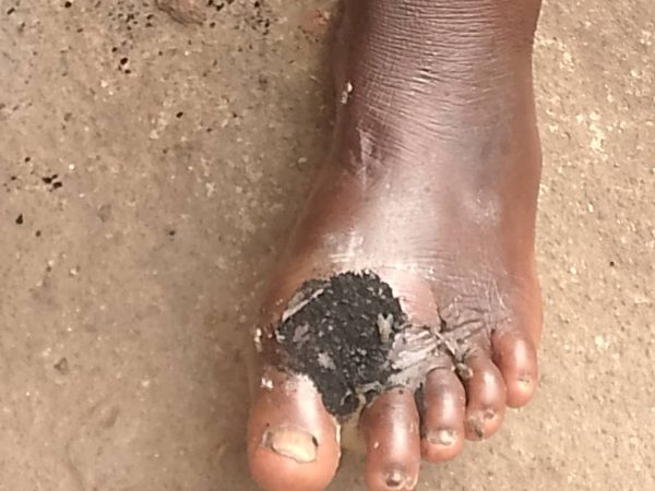 Demande d'aide pour soigner ma maman
