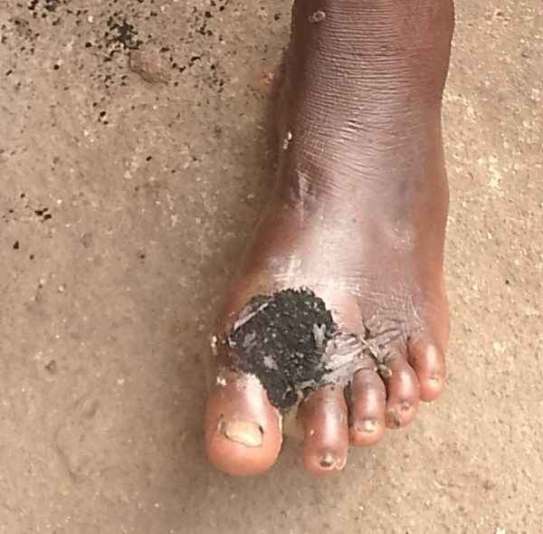 Demande d'aide pour soigner ma maman