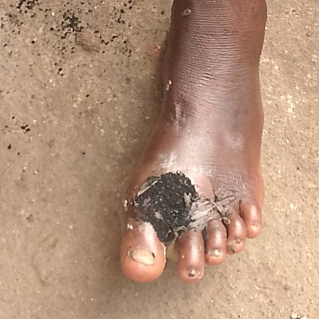 Demande d’aide pour soigner ma maman